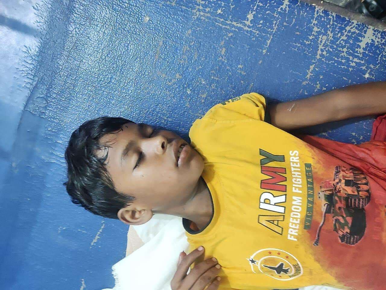 Samastipur News:पटाखा की जद में आने से पेट फट कर आंत आया बाहर