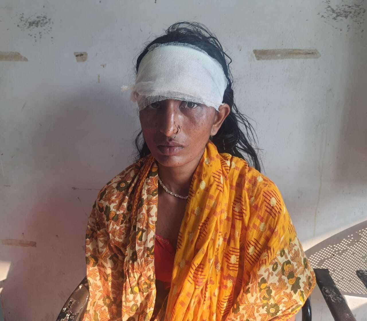 पति ने बैट से प्रहार कर पत्नी का फोड़ा सिर