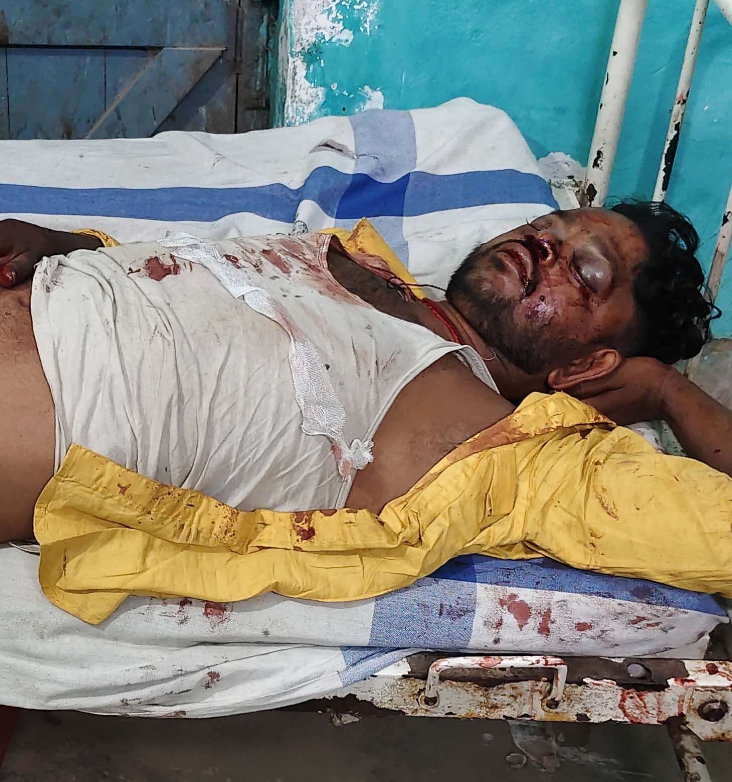 ट्रैक्टर की ठोकर से बाइक सवार गंभीर रूप से घायल,  रेफर