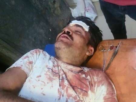 रजौन कला में पुराने विवाद को लेकर मारपीट, दो लोग घायल