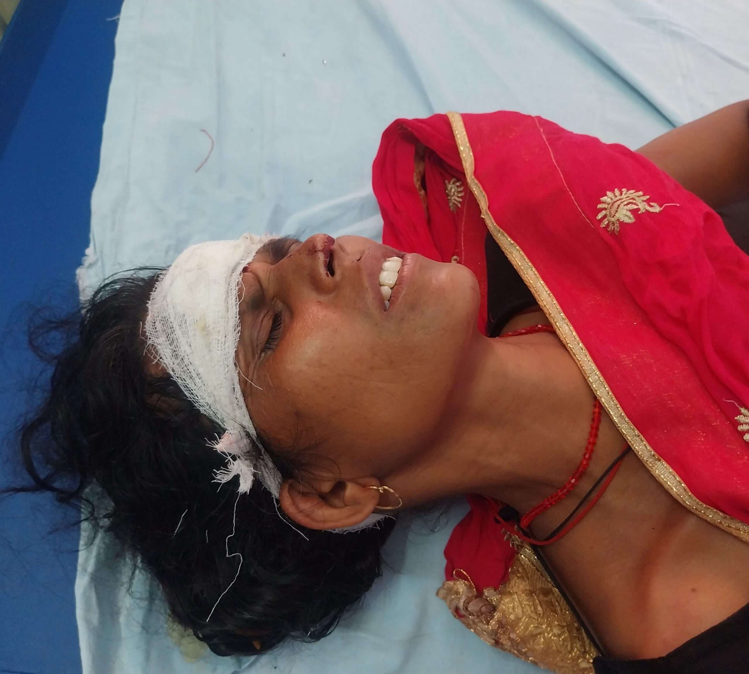 Bokaro News : मवेशी को बचाने में ऑटो पलटा, चार लोग घायल