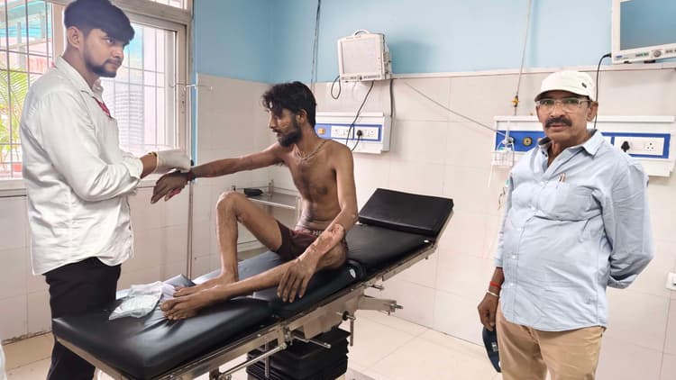 बाइक में लगी अचानक आग, युवक झुलसा