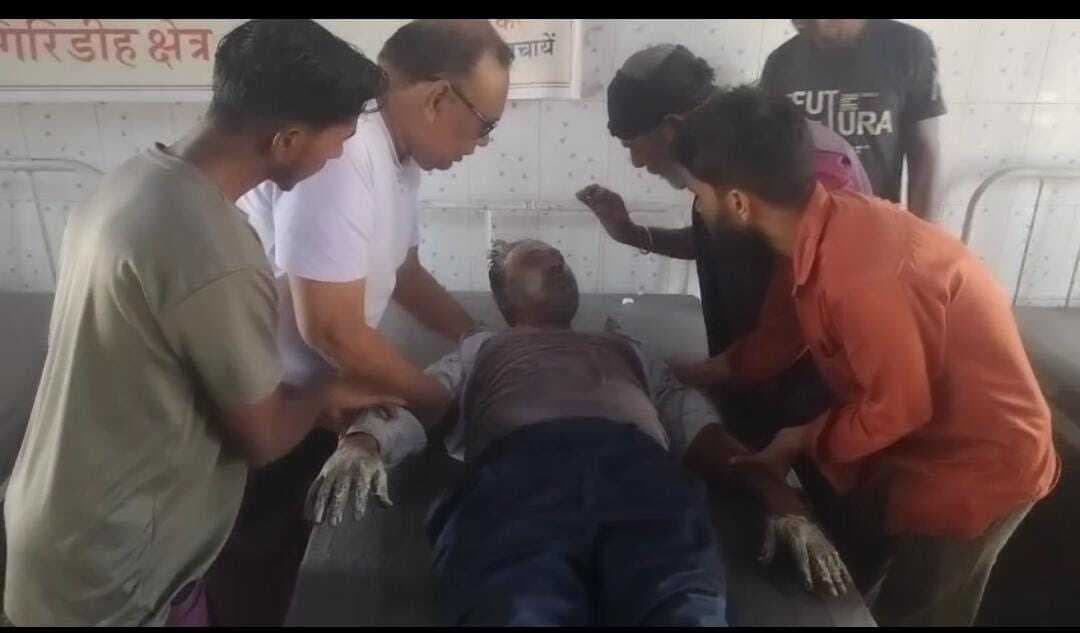 Giridih News :मल्टी मीटर ब्लास्ट करने से इलेक्ट्रिशियन जख्मी, रेफर