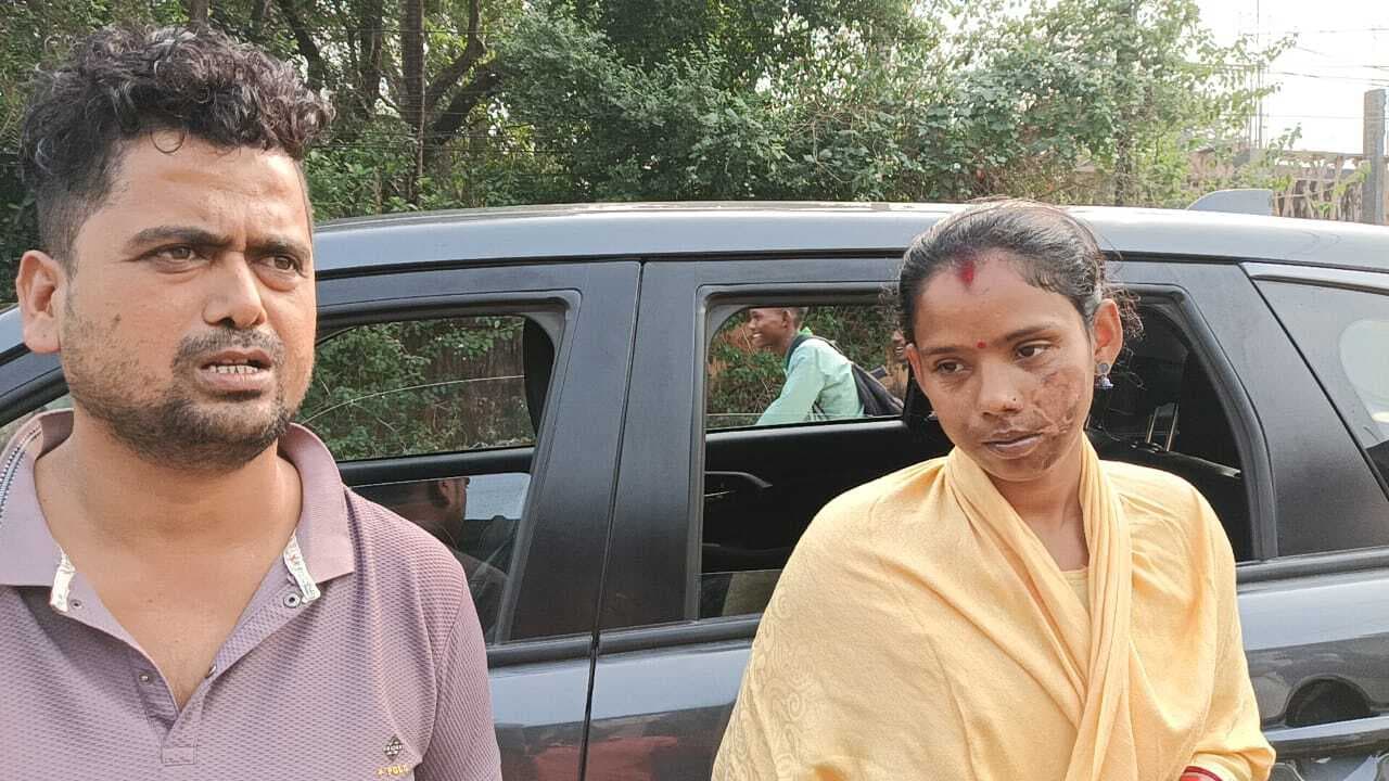 आपसी विवाद में मुंह पर फेंका चाय, महिला झुलसी