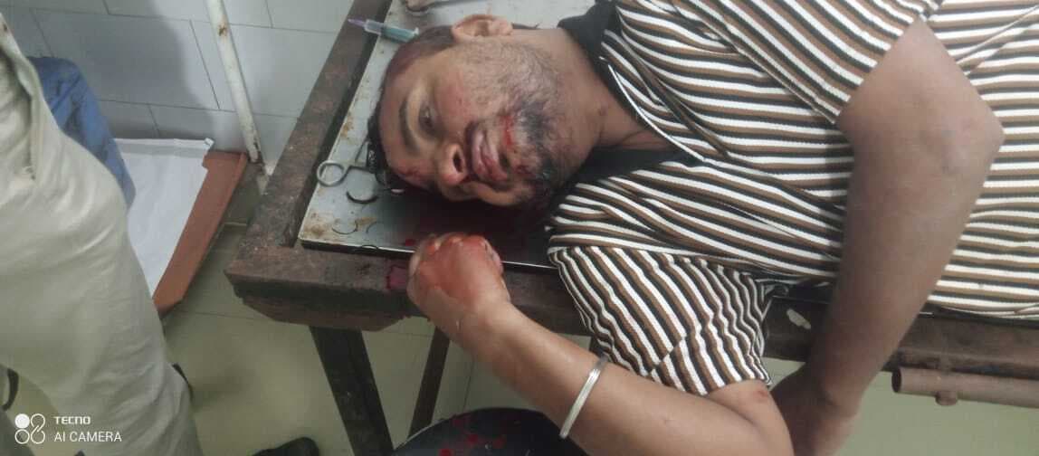 Giridih News :ट्रक की चपेट में आकर युवक घायल, हंगामा