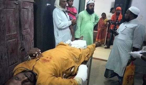 पथरगामा में सड़क हादसे में बाइक सवार के दोनों हाथ गंभीर रूप से जख्मी