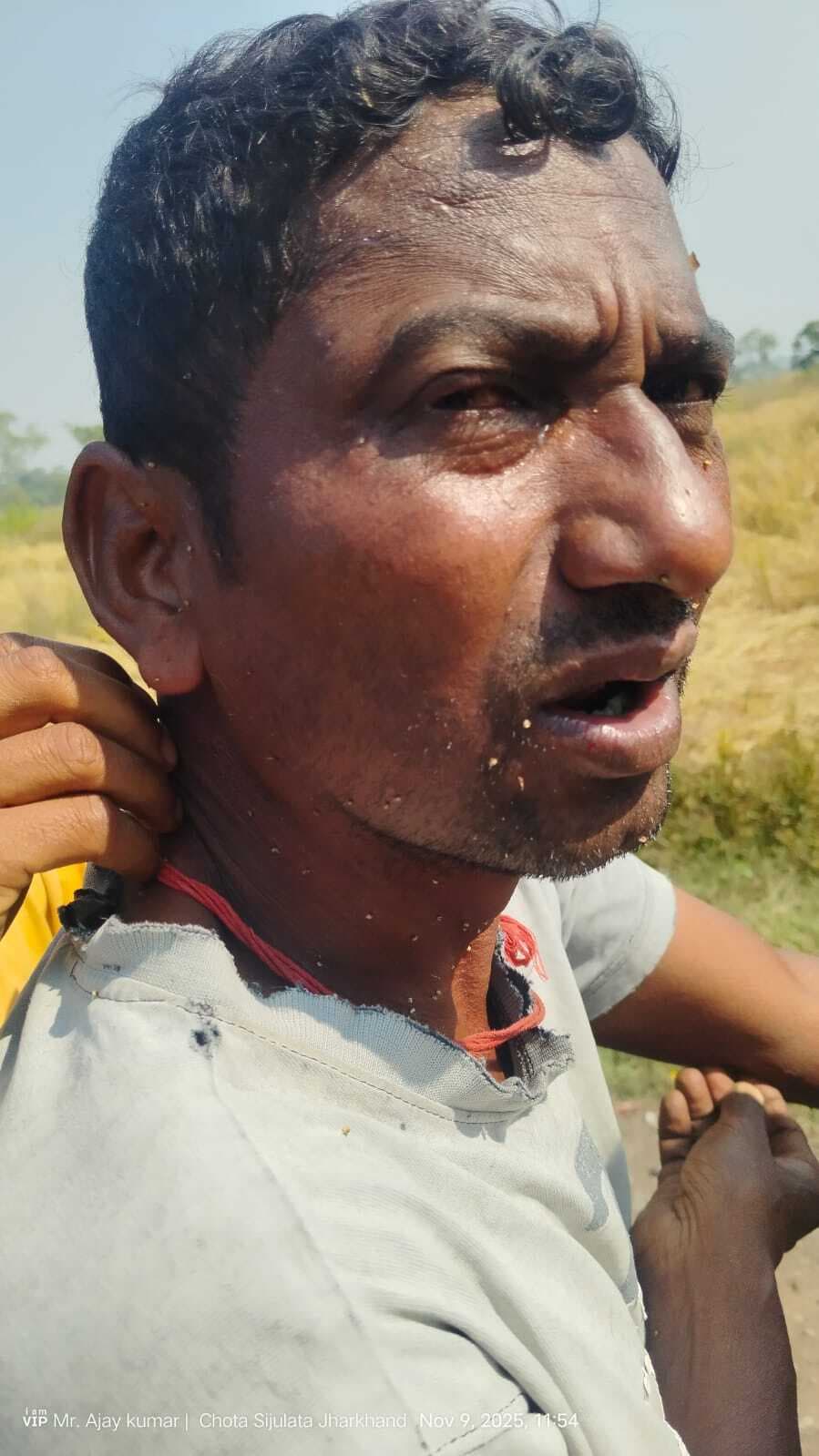 Seraikela Kharsawan News : राजनगर में मधुमक्खियों के हमले से एक ही परिवार के तीन सदस्य घायल