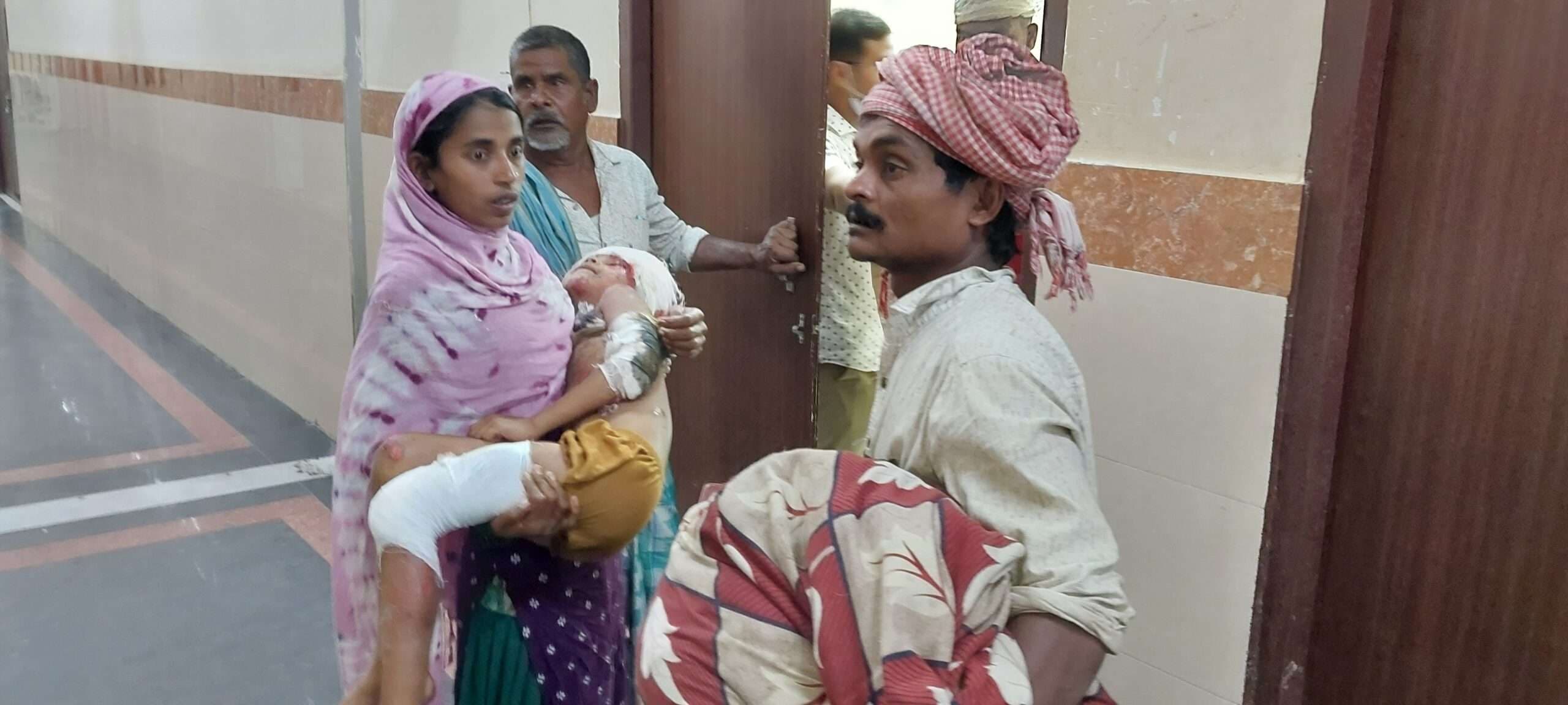 बाइक सवार खेल रही बच्ची को मारी टक्कर, गंभीर रूप से घायल