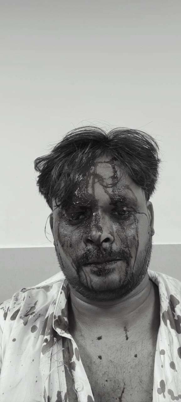 Jamshedpur News : उलीडीह : अधिवक्ता पर बहन के ससुरालवालों ने किया हमला, केस