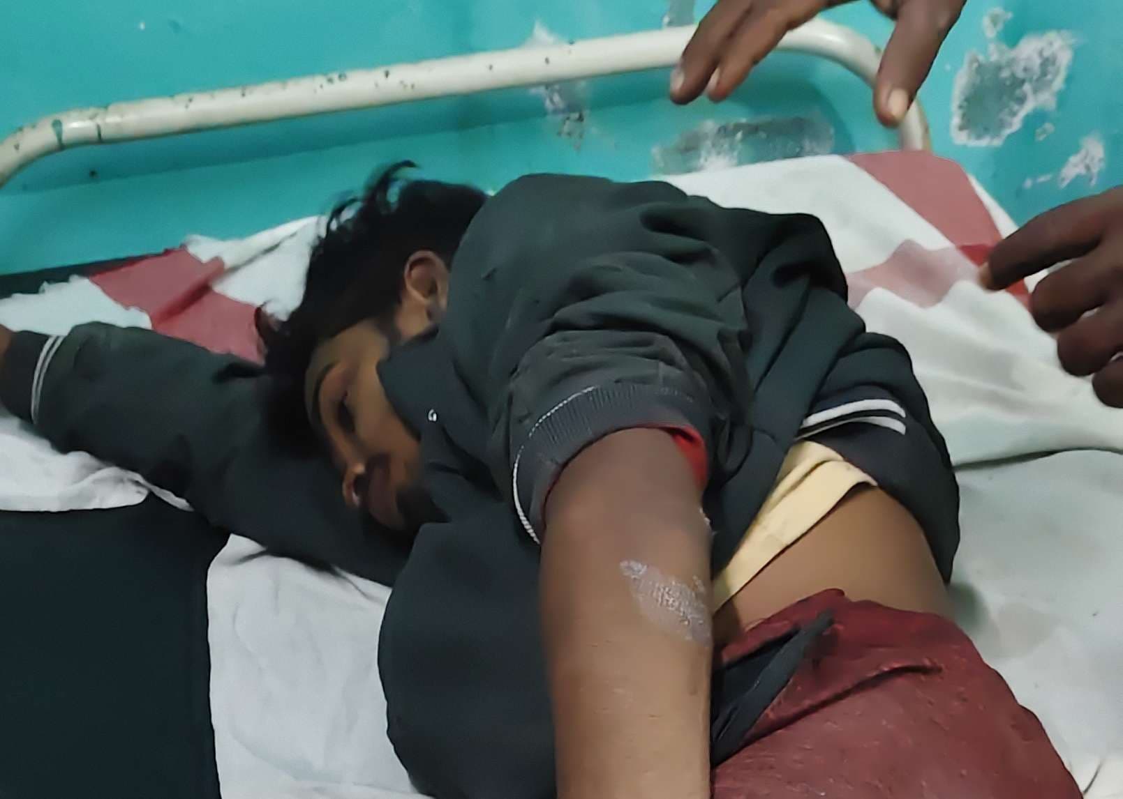 दो बाइकों की टक्कर में दो युवक की हालत गंभीर, रेफर