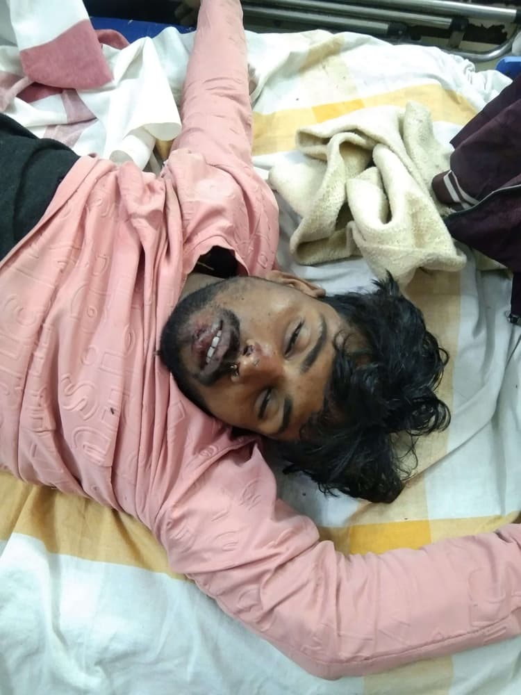 Samastipur News:सड़क दुर्घटना में अज्ञात बाइक सवार युवक की मौत