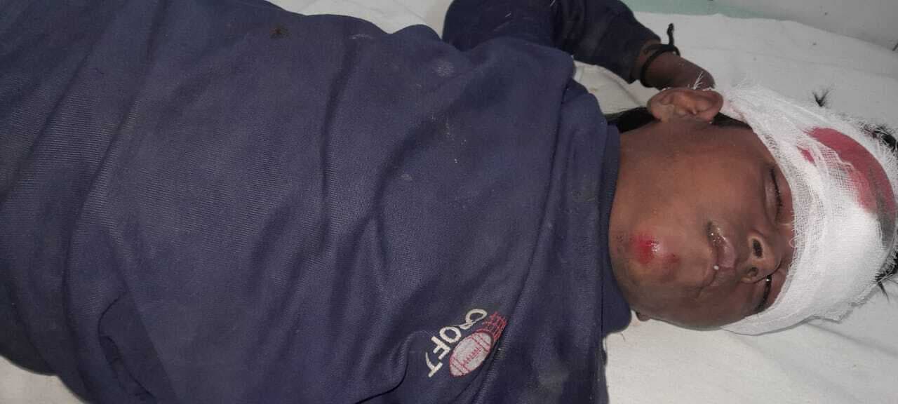 एनएच-531 पर हादसे में बेतिया की बच्ची गंभीर रूप से जख्मी, मदद के बजाय राहगीर बनाते रहे वीडियो