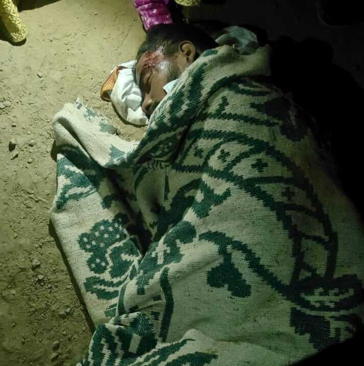 पुलिया के गड्ढे में गिरा अधेड़, गंभीर रूप से जख्मी