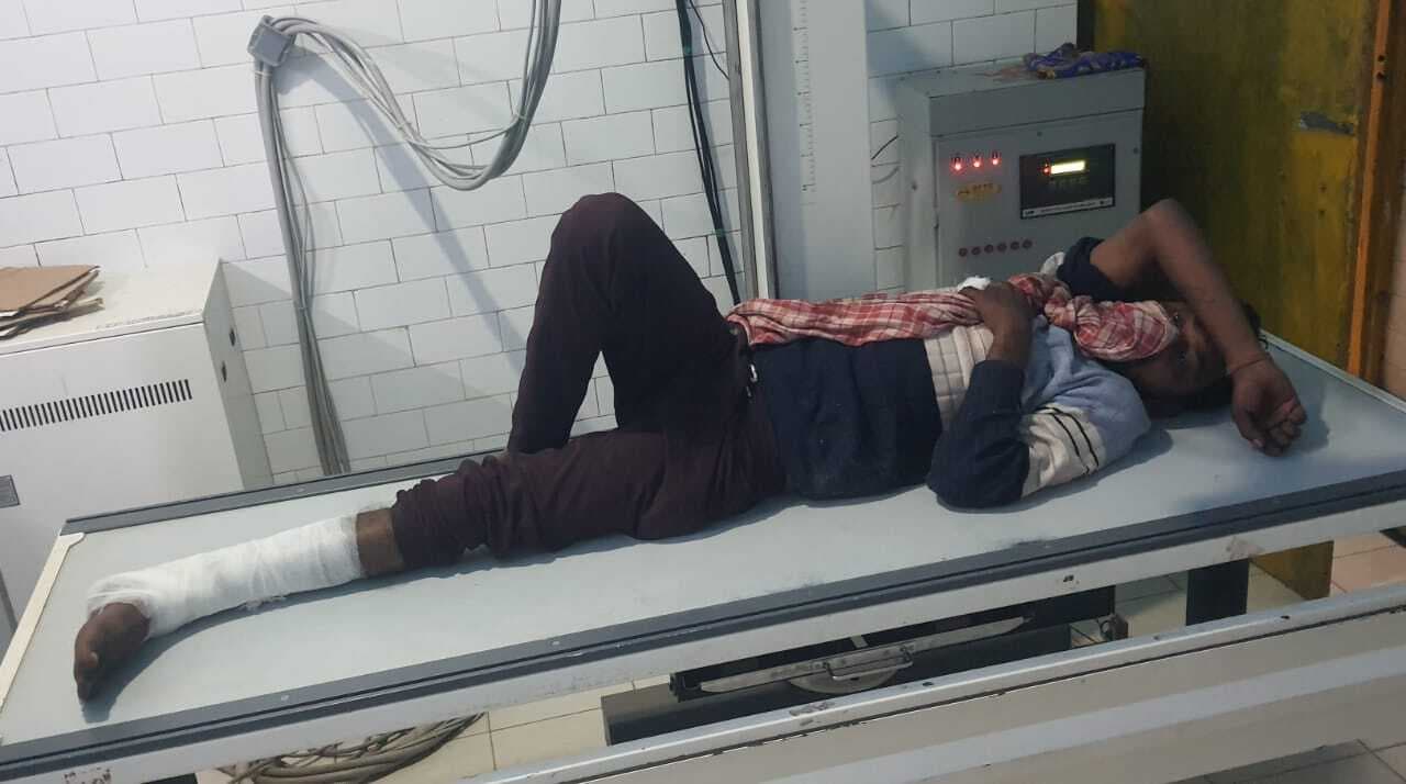 स्काॅर्पिओ की टक्कर से बाइक चालक का टूटा पैर, देवघर हुआ रेफर