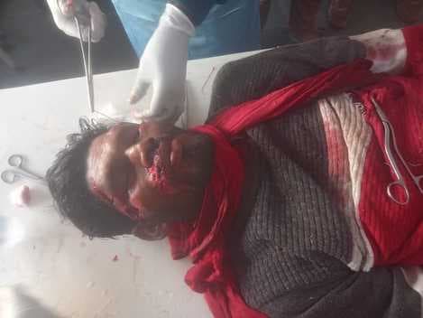 सड़क दुर्घटना में बाइक चालक गंभीर रूप से घायल