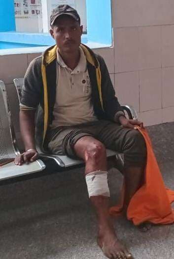 टोटो पलटने से चालक जख्मी, अस्पताल में भर्ती