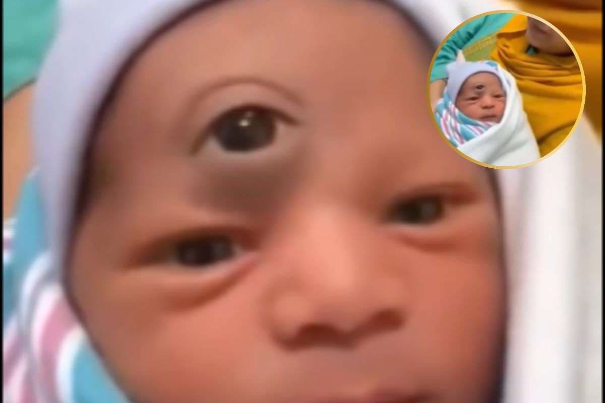 Viral Video : तीन आंख वाले बच्चे का वीडियो वायरल, देखकर लोग हैरान, जानें सच्चाई