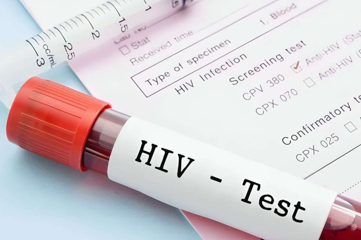 Bihar News: बिहार में HIV मरीजों को बड़ी राहत, AIIMS और IGIMS समेत खुलेंगे 5 नए ART सेंटर