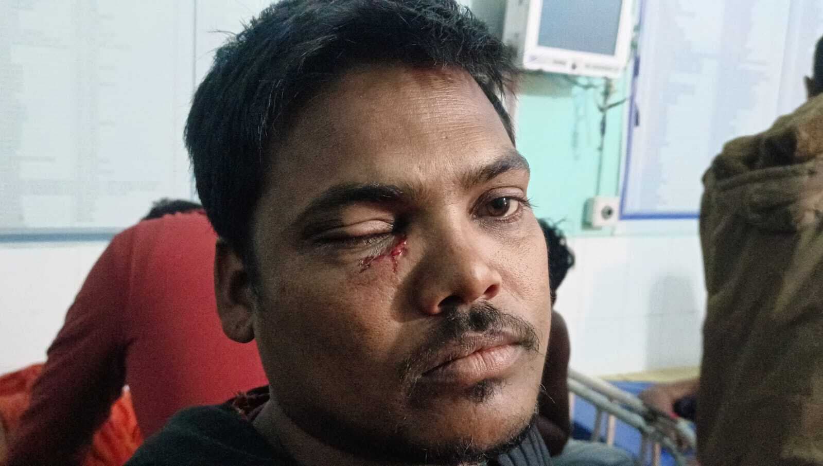 किशोरी को भगाने के विवाद में जमकर चले लाठी-डंडे, एक दर्जन घायल, तीन गंभीर