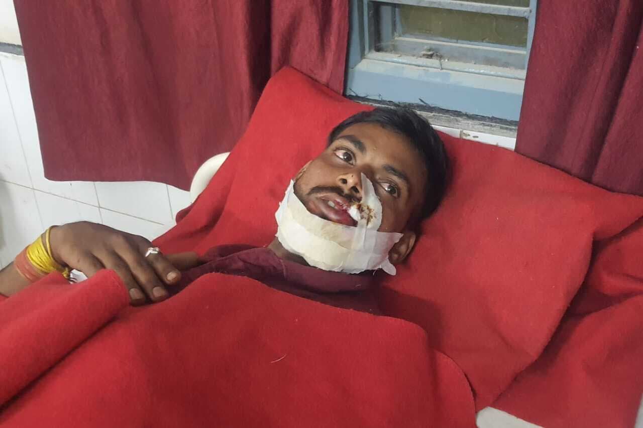 कुत्ता बचाने में हुई बाइक दुर्घटना में युवक घायल