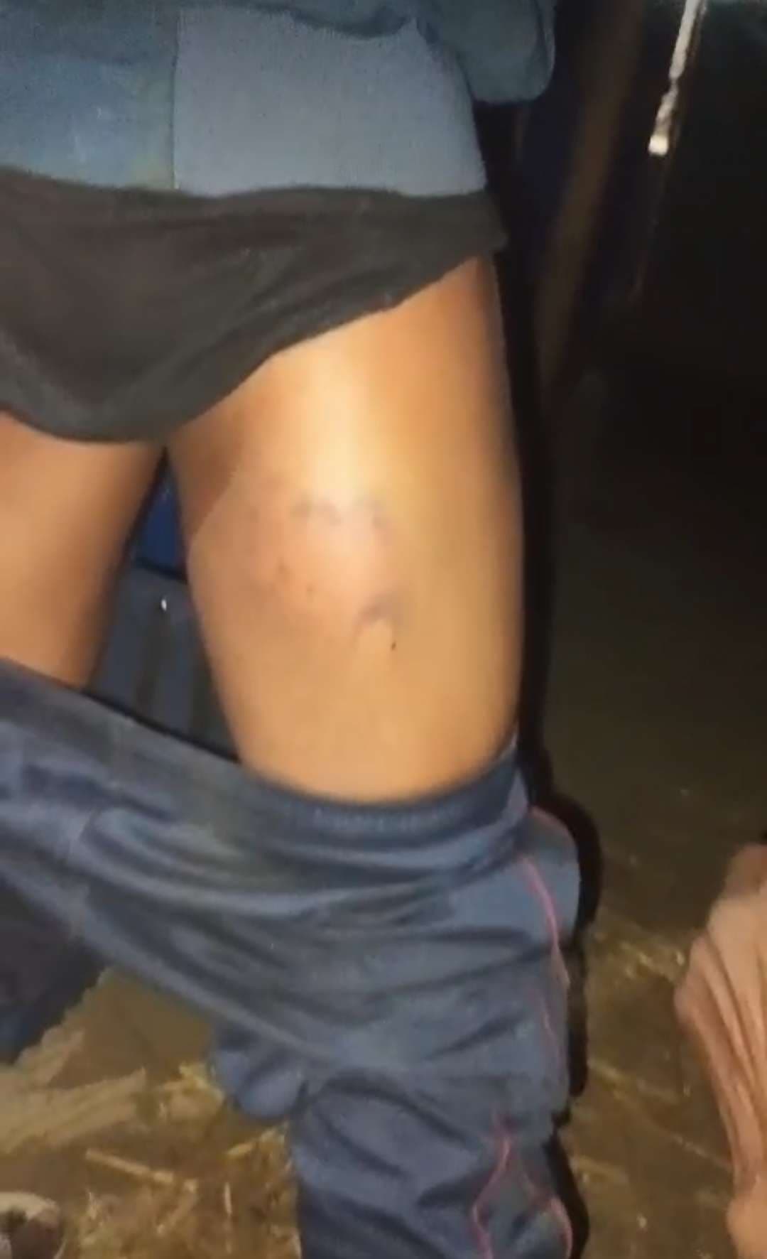 हिरासत में मारपीट, गाली-गलौज और 40 हजार रुपए की अवैध वसूली का लगाया आरोप