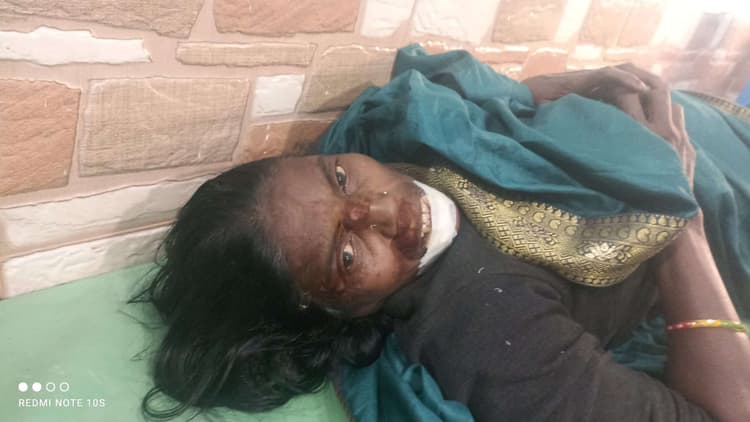 Dhanbad News : डी-नोबिली स्कूल चंद्रपुरा जा रही कार ने बाइक को मारा धक्का, मां-बेटा घायल