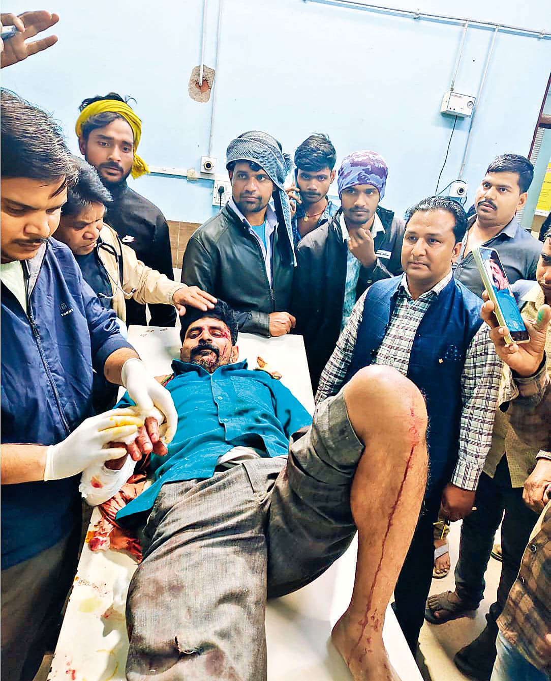 कोचस में तेंदुए के हमले से छह लोग घायल