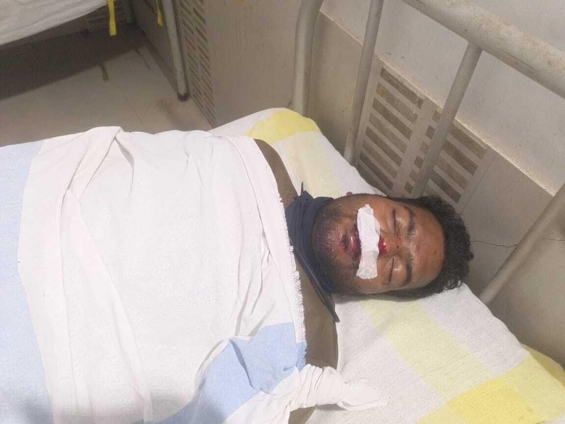 सड़क हादसे में बाइक सवार युवक गंभीर रूप से घायल