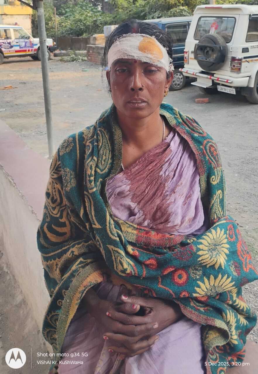 छोटी बहन के पति पर मारपीट करने का आरोप