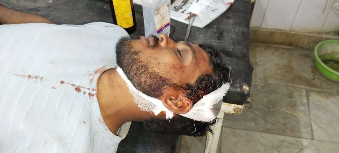 जमीन विवाद में दो पक्षों में मारपीट, चार जख्मी