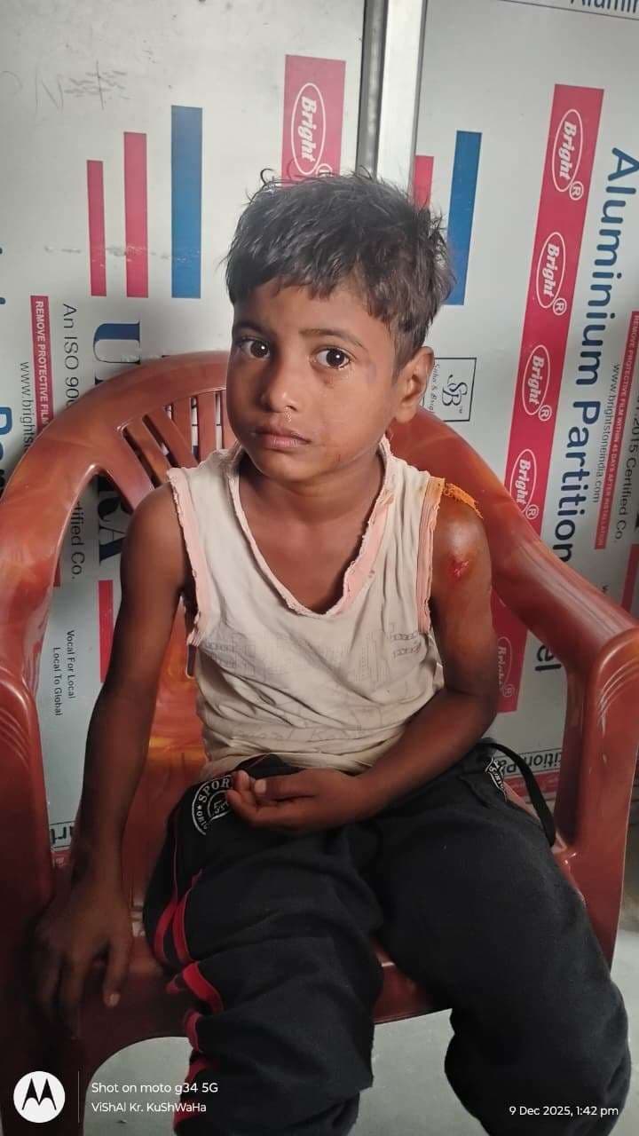 अलग-अलग जगहों पर कुत्तों ने 12 को काटा, अधिकतर बच्चे