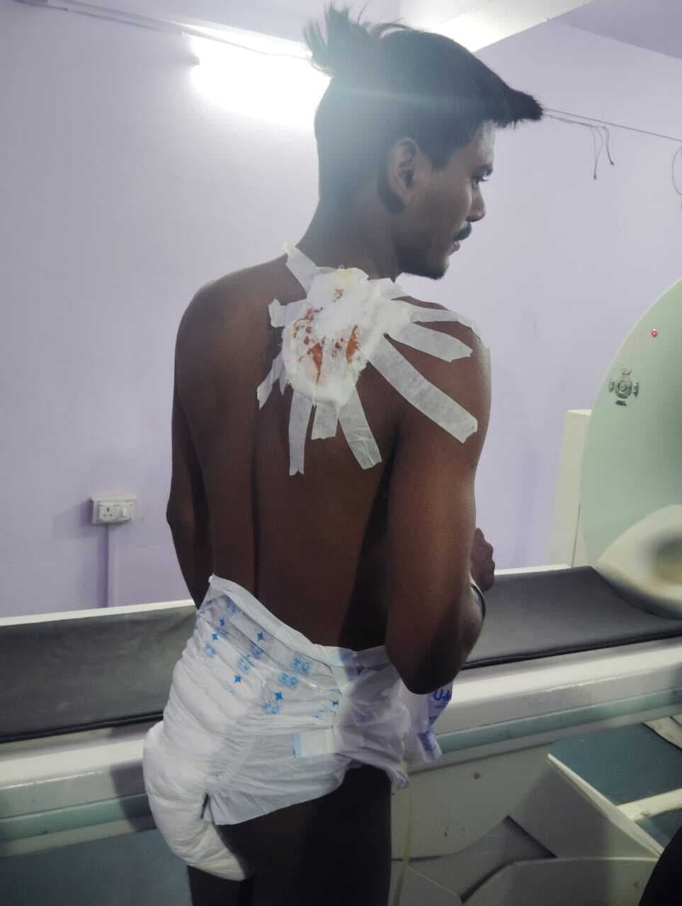 अलाव सेंक रहे युवक को उसके दोस्त ने ही मारी गोली