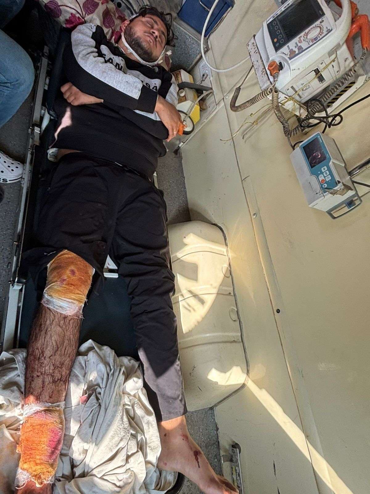 राजद नेता व पार्षद को गोली मार किया जख्मी