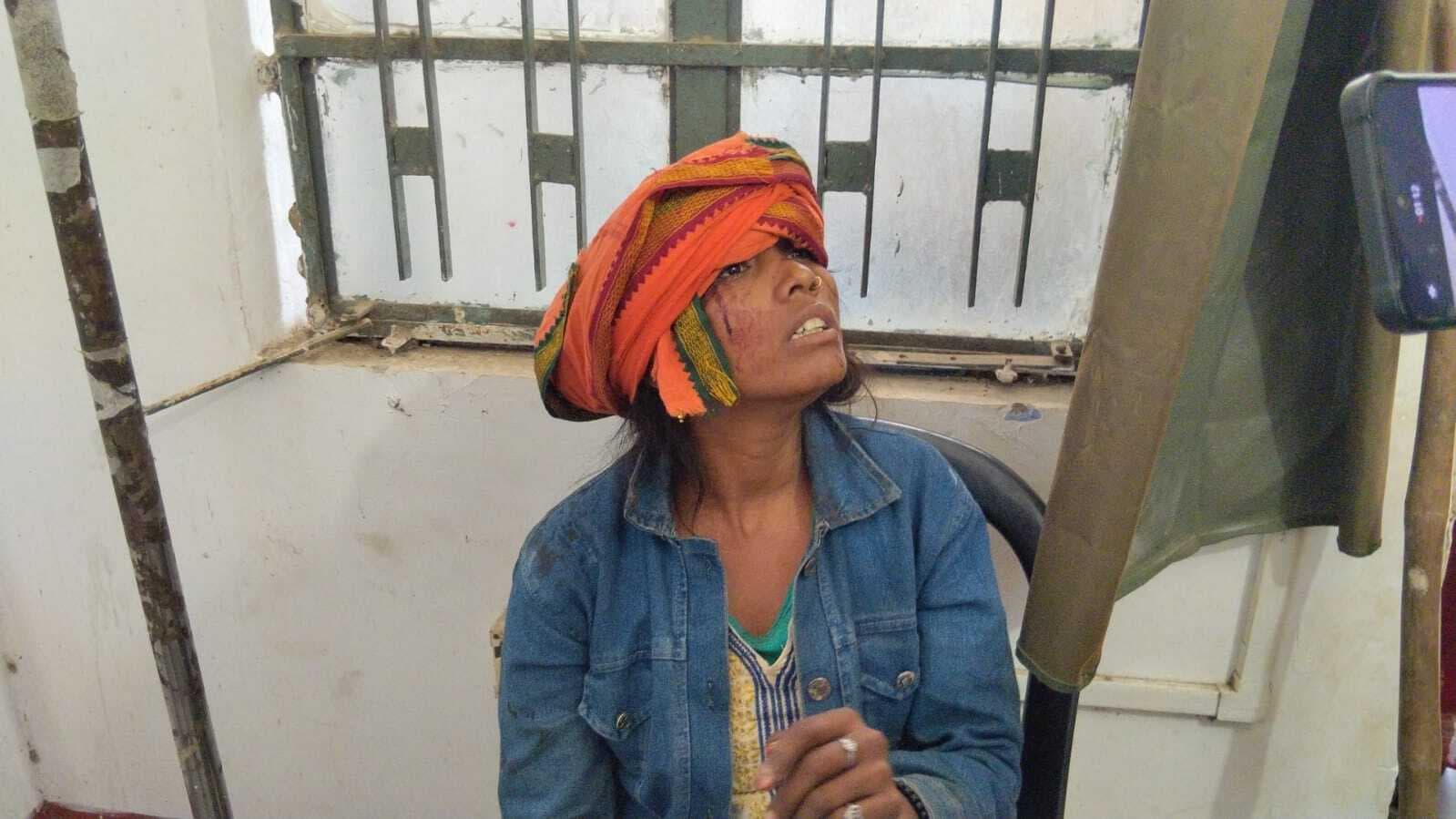 मारपीट में सास, बहू समेत तीन जख्मी