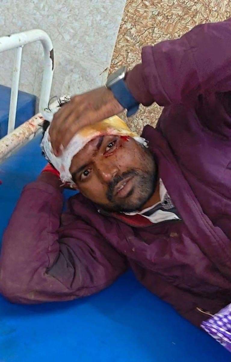 हाइवा की टक्कर से बाइक सवार दो युवक घायल, एक रेफर