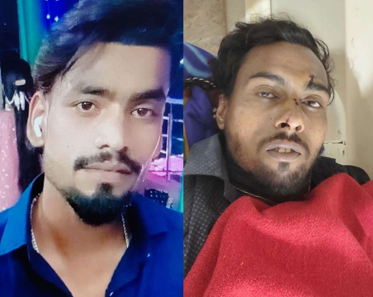 Jamshedpur News : कदमा : अज्ञात वाहन की टक्कर से स्कूटी सवार युवक की मौत, साथी घायल