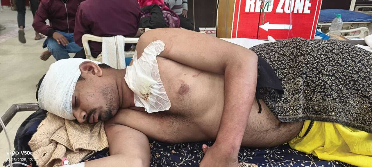 दो लोगों को लगी गोली, हालत गंभीर