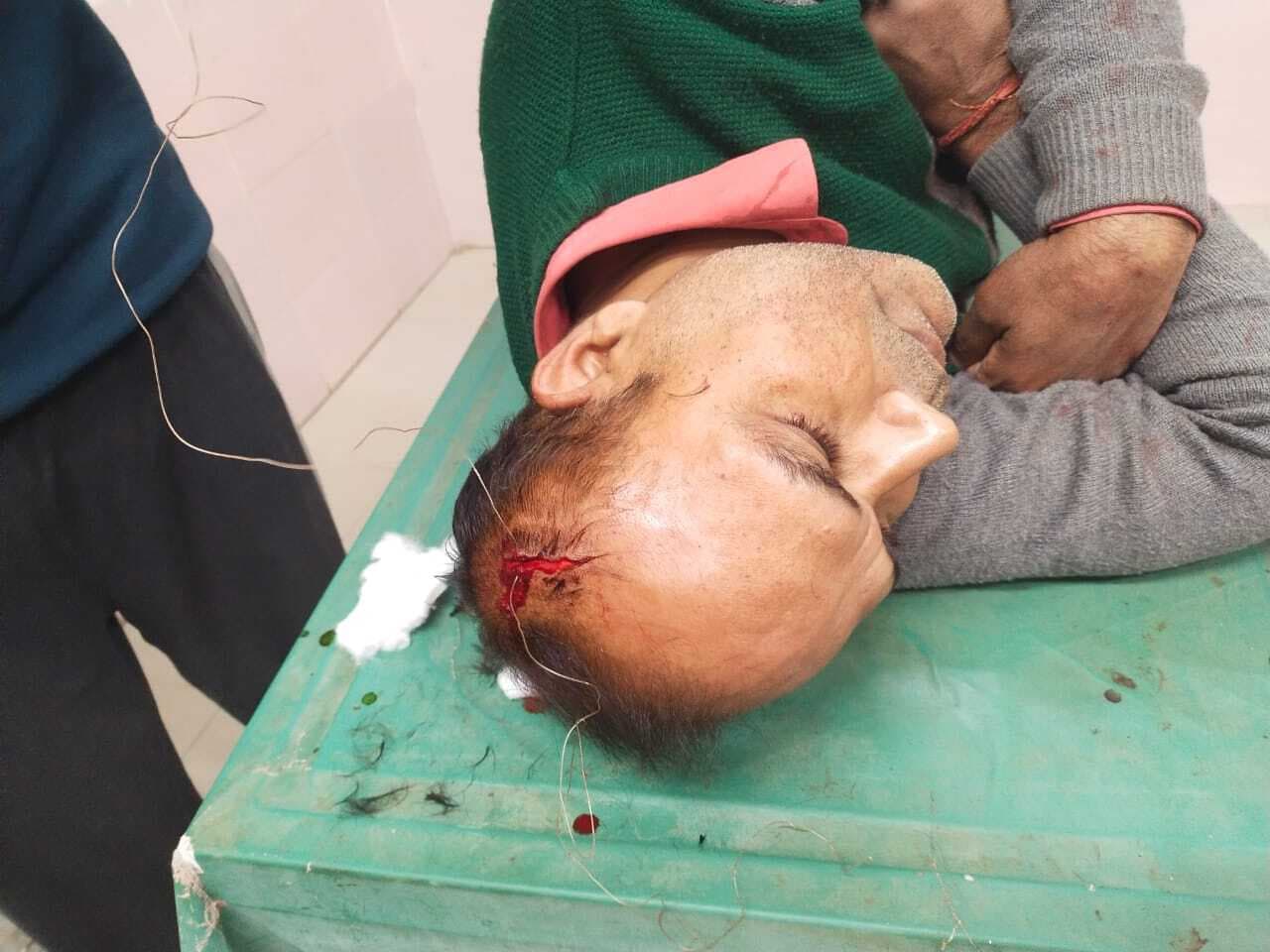 Samastipur News:विवाद में युवक को पीट कर किया जख्मी