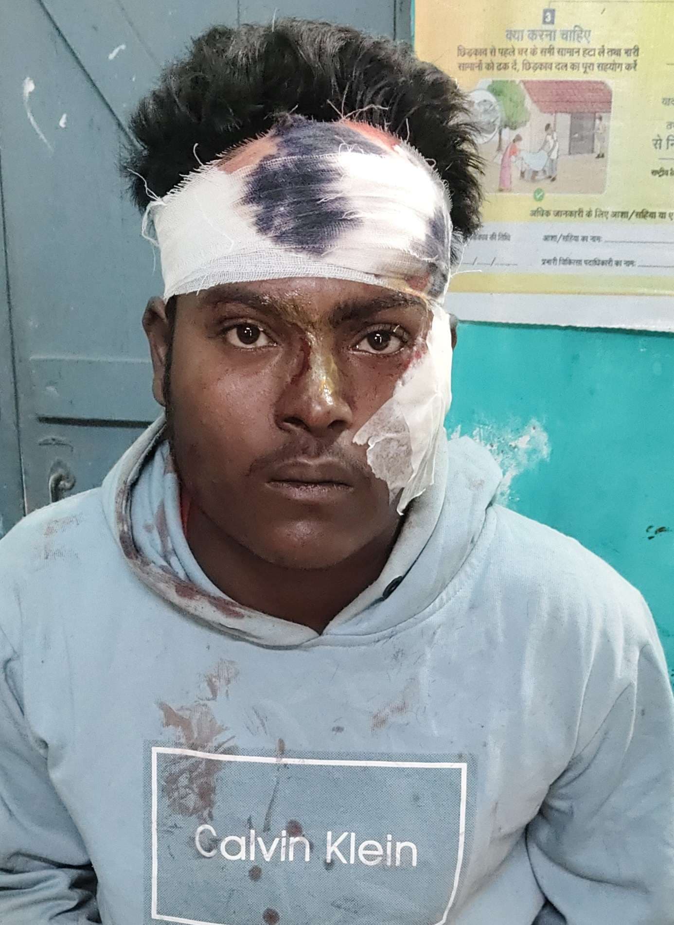 दो बाइक की सीधी टक्कर में चालक की स्थिति गंभीर, रेफर