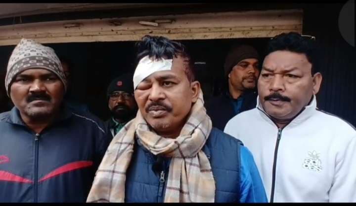Dhanbad News: केबल लूट का विरोध करने पर मुखिया पर हमला, बम फोड़ कर भागे