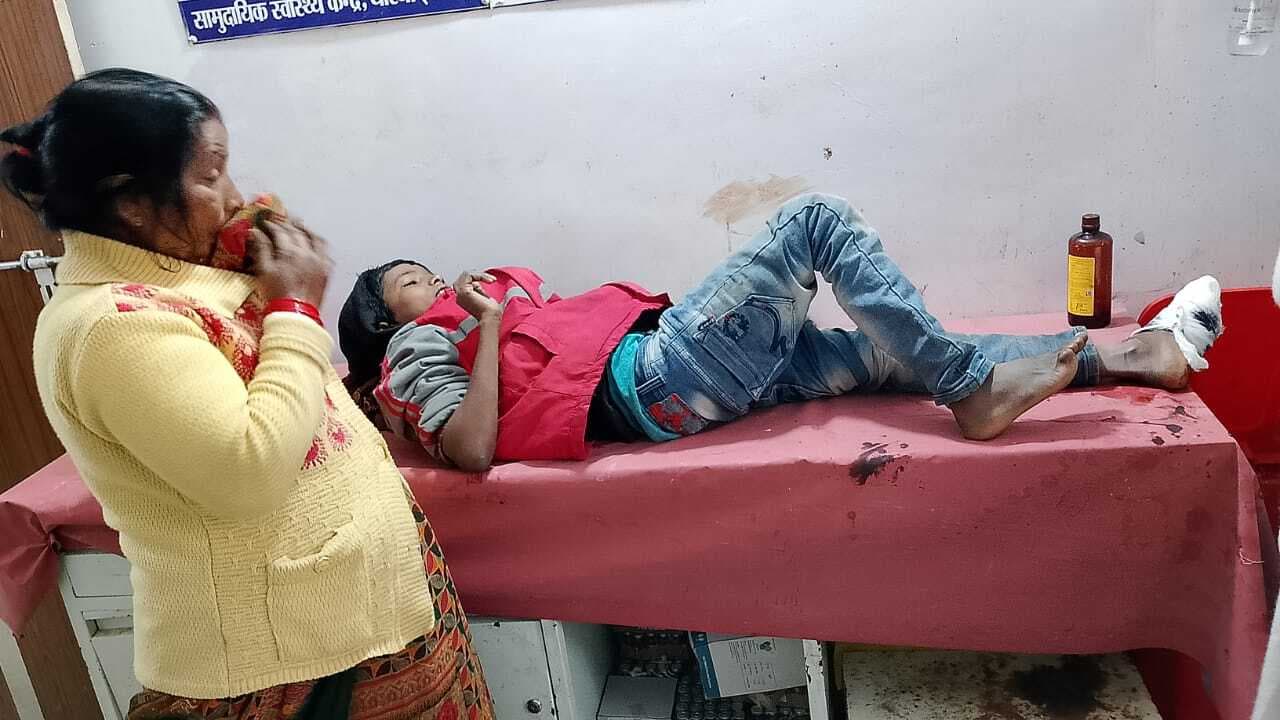 स्कूल जाने के लिए बस का इंतजार कर रहे छात्र को बाइक ने मारा टक्कर