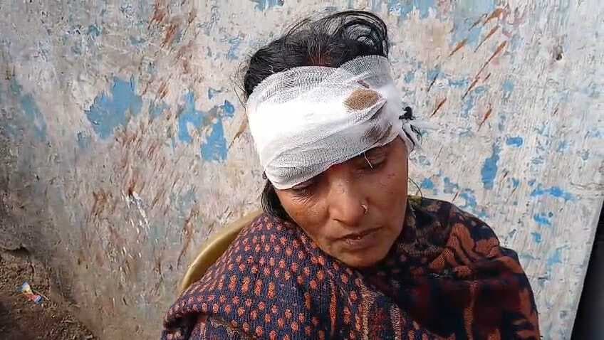 नाली का गंदा पानी बहाने से मना करने पर महिला से मारपीट, घायल