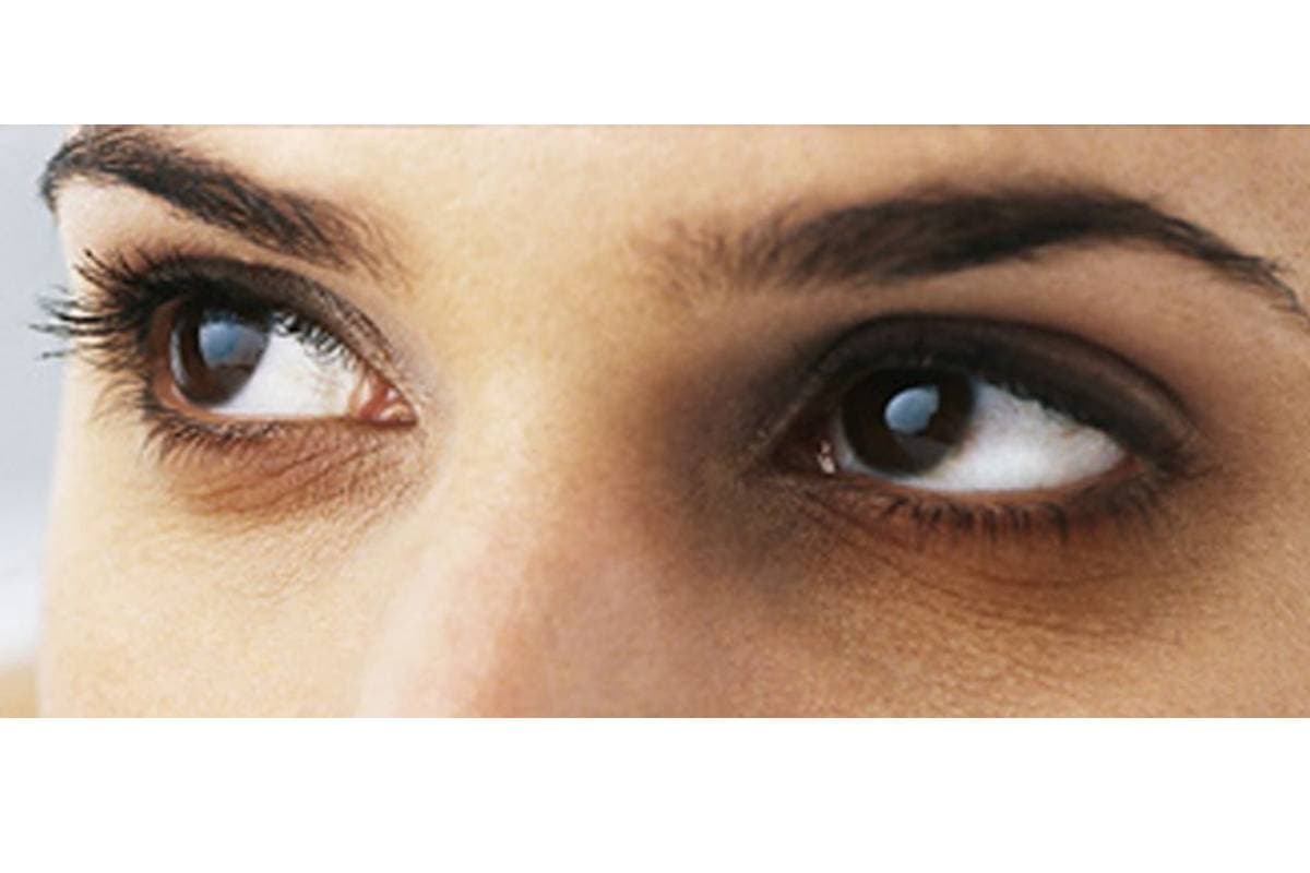 Dark Circles Removal Tips: डार्क सर्कल्स हटाने हैं? आंखों के नीचे काले घेरों के लिए बादाम तेल है असरदार घरेलू उपाय