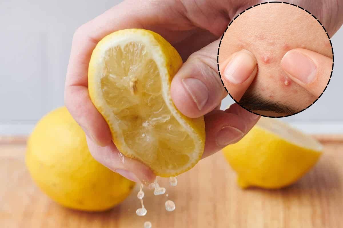 Lemon Juice Side Effects: चेहरे की रंगत छीन सकता है नींबू का रस, ये लोग बिल्कुल न करें इस्तेमाल Lemon Juice Side Effects: चेहरे की रंगत छीन सकता है नींबू का रस, ये लोग बिल्कुल न करें इस्तेमाल