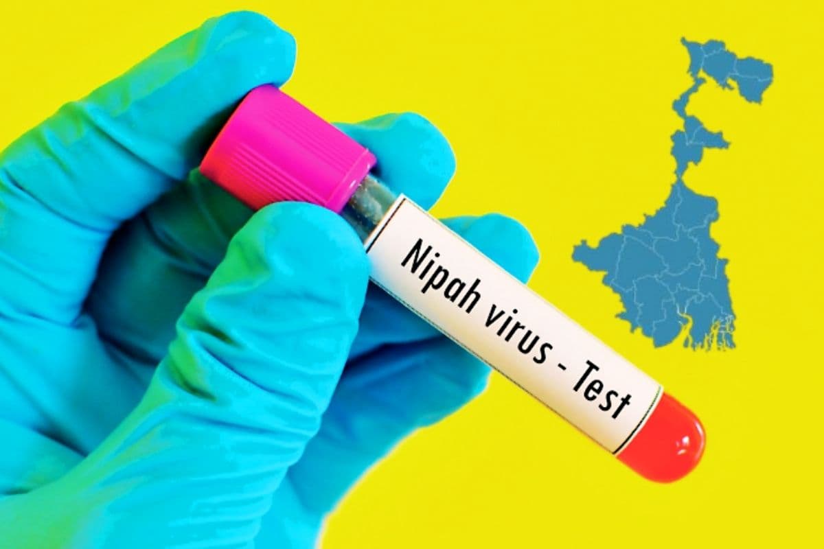 निपाह वायरस से संक्रमित नर्सों की हालत गंभीर, कोलकाता के अस्पताल में किया गया शिफ्ट