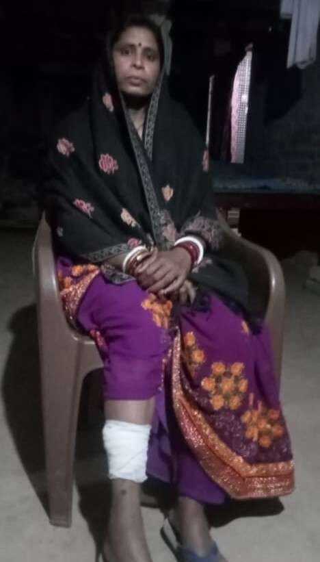 सुखासन तेतरिया में बंदर ने महिला पर किया हमला, जख्मी