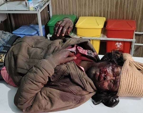 वाहन की टक्कर के बाद बाइक सवार युवक घायल, रेफर