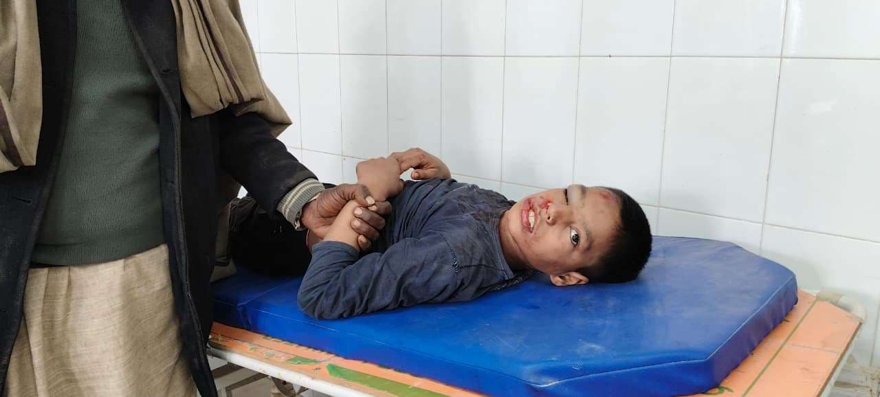 पतंग उड़ाने में छत से गिरा किशोर, वाराणसी रेफर