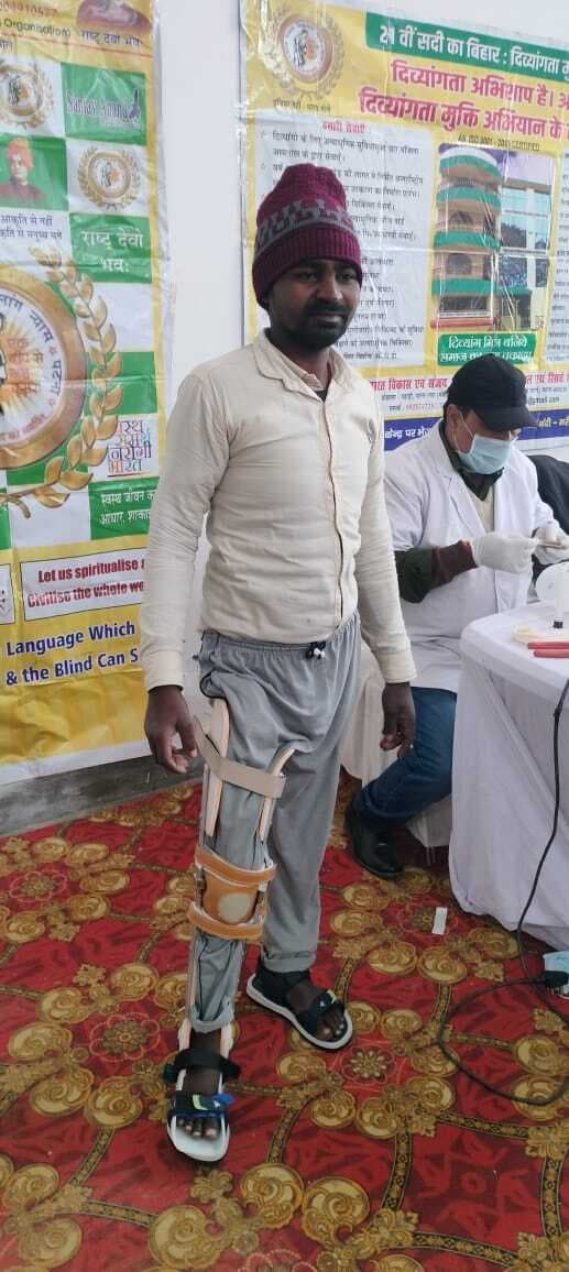 गांधी मैदान में गूंजी दिव्यांगों की मुस्कान, 30 को मिले कृत्रिम अंग