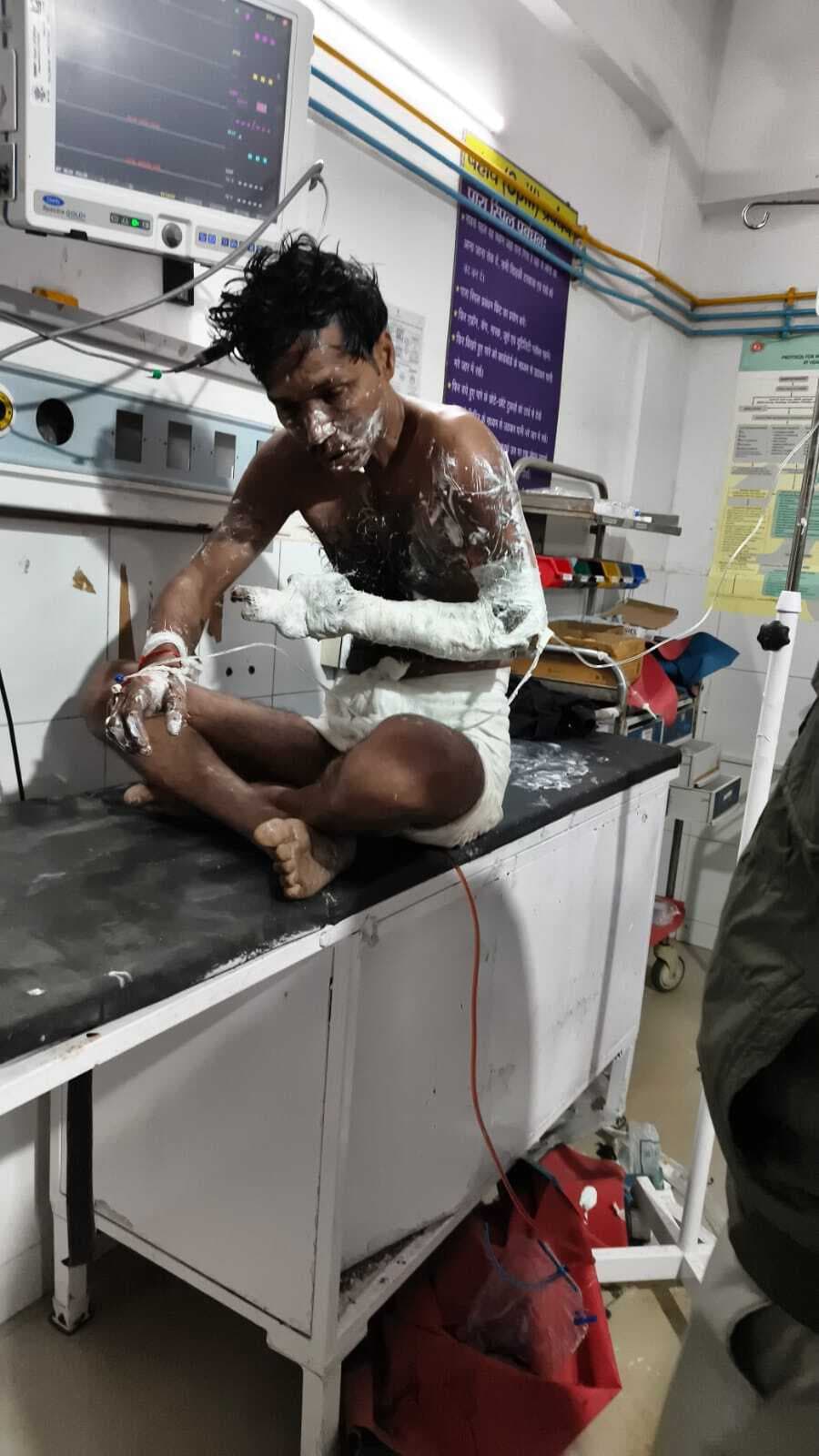 हाई वोल्टेज तार के संपर्क में आने से बिजली मिस्त्री घायल, पटना रेफर